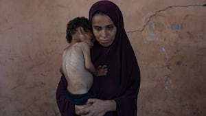 Starved to death: 21 children die of hunger in Gaza in three days