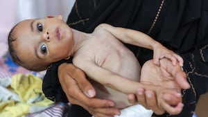 Starvation deaths rise in Gaza as world decries 'man-made' crisis